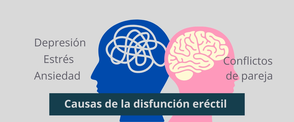 Ilustración sobre causas psicológicas de la disfunción eréctil como estrés, ansiedad y depresión